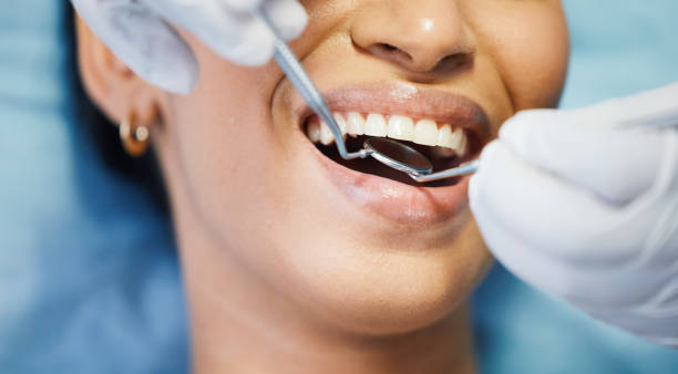 Best Emergency Tooth Extraction in Malakoff, TX