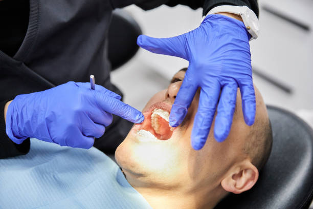 Best Emergency Treatment for Dental Infections or Abscesses in Malakoff, TX